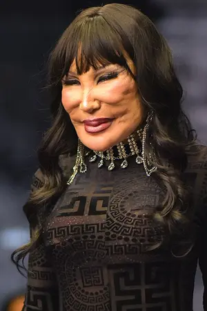 Lyn May