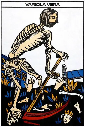 Variola vera (1982)