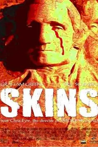 Skins (2002)